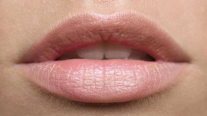 veja-como-aumentar-o-volume-dos-labios-naturalmente veja-como-aumentar-o-volume-dos-labios-naturalmente