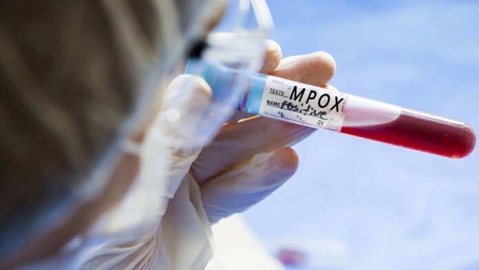 autoridades-alertam-populacao-durante-carnaval-apos-confirmacao-de-mpox-em-porto-alegre