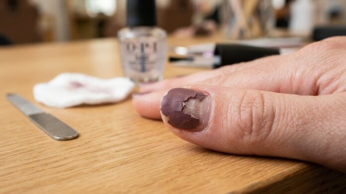 adeus-ao-esmalte-que-lasca-no-terceiro-dia:-esmalte-que-dura-mais-de-uma-semana adeus-ao-esmalte-que-lasca-no-terceiro-dia:-esmalte-que-dura-mais-de-uma-semana
